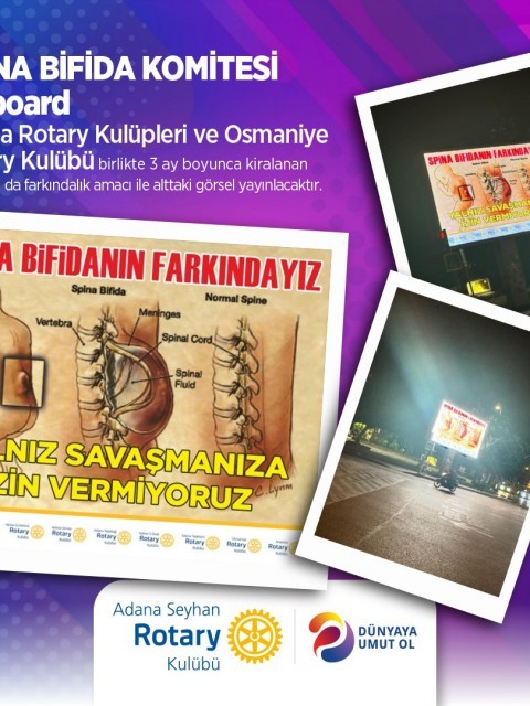 SPİNA BİFİDA KOMİTESİ Billboard