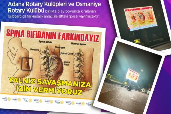 SPİNA BİFİDA KOMİTESİ Billboard