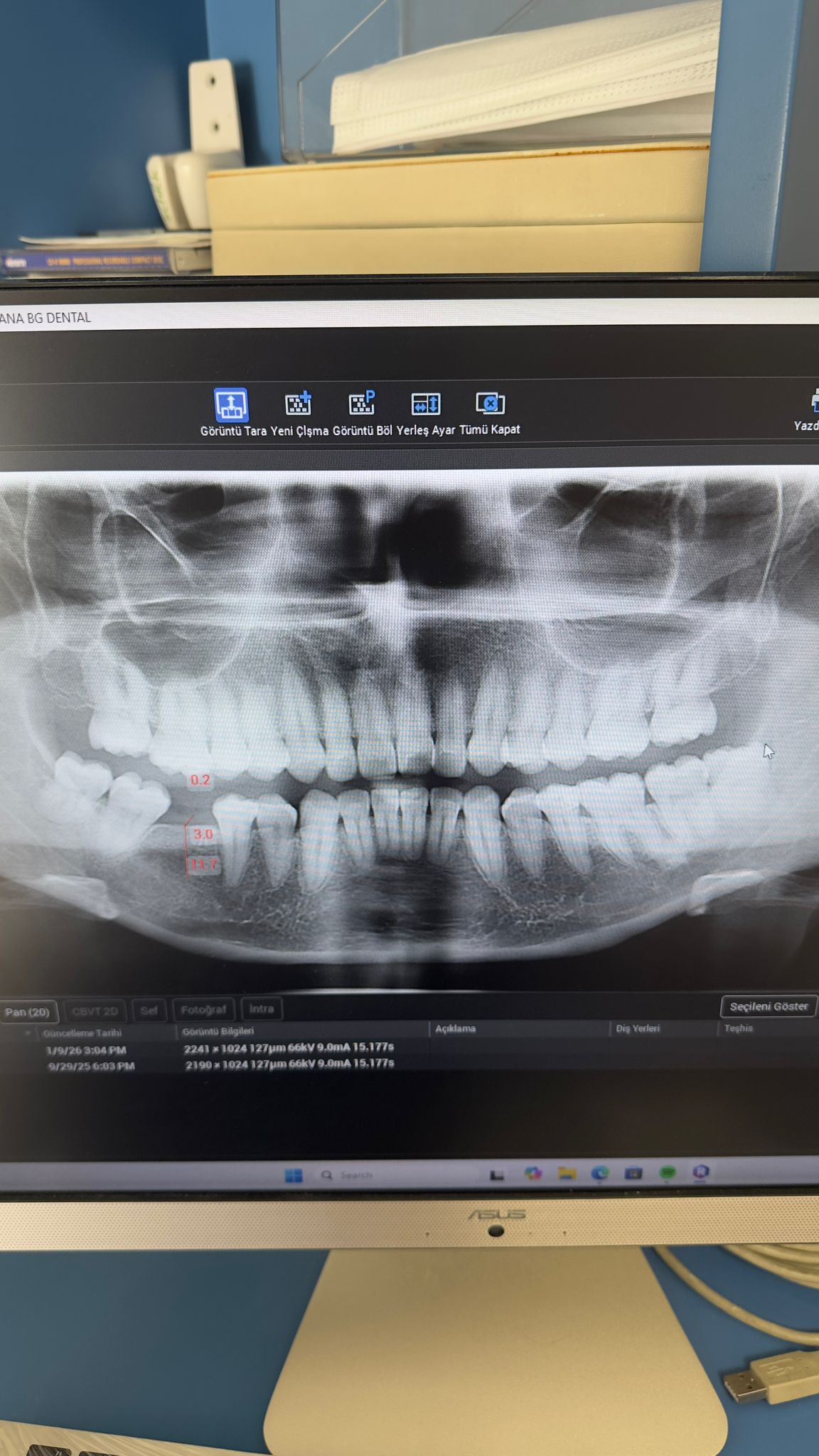 Engelli şehit ve Gazilere Diş İmplant tedavisi