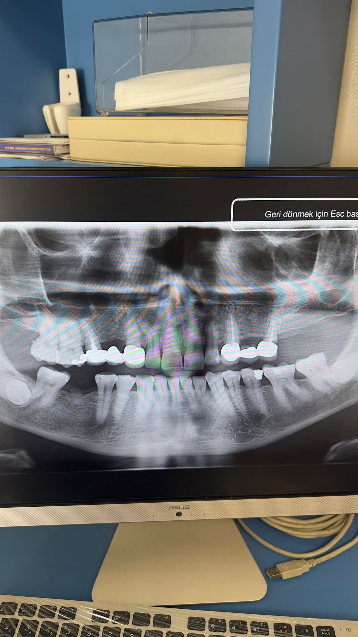 Engelli şehit ve Gazilere Diş İmplant tedavisi