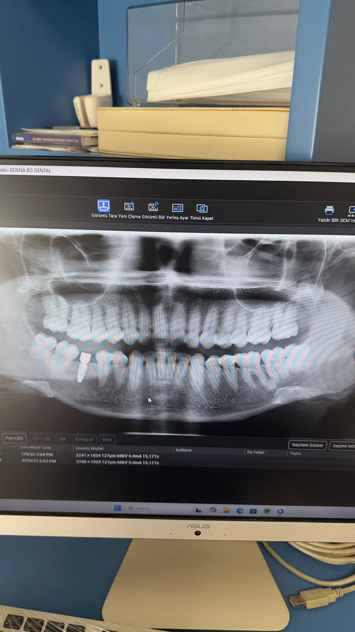 Engelli şehit ve Gazilere Diş İmplant tedavisi